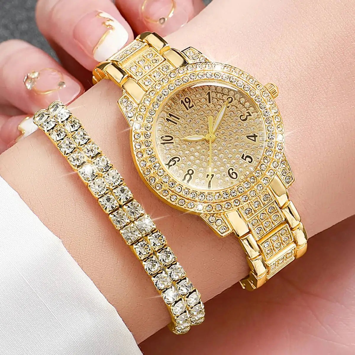 Radiant Charm – Luxury Women’s Wristwatch Set